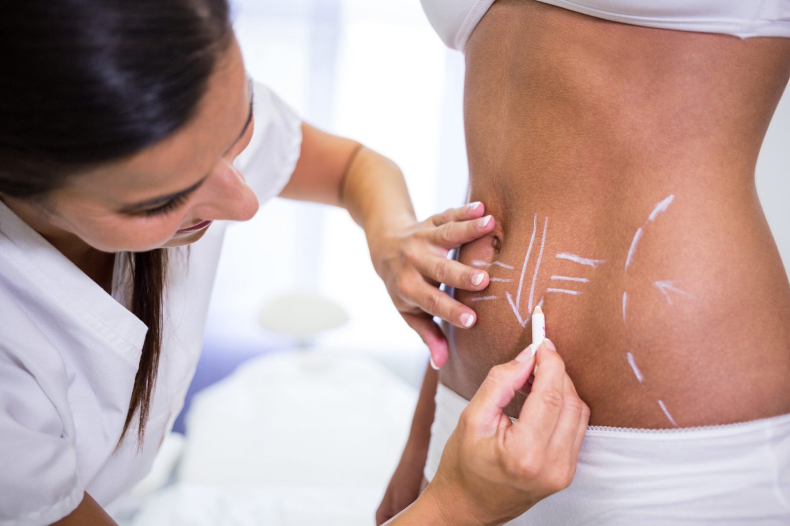 abdominoplastia-blog